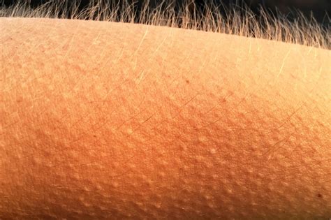 Эмоциональные факторы, вызывающие мурашки по коже