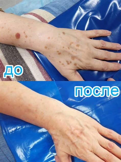 Эстетические причины