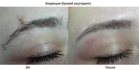 Этапы процедуры шугаринга рук в домашних условиях