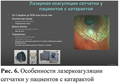 Эффективное использование компьютера для пациентов с катарактой
