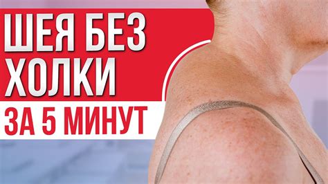 Эффективные методы избавления от горба
