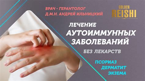 Эффективные методы лечения аутоиммунных заболеваний без лекарств