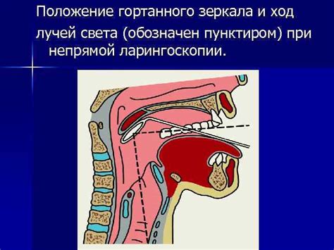Эффективные методы лечения и восстановления голосового аппарата
