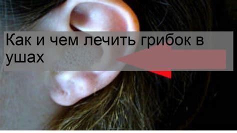 Эффективные методы лечения шишки в ухе