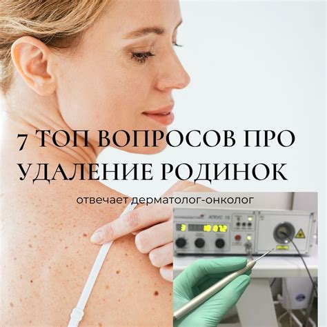 Эффективные методы удаления родинки лазером дома