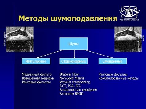 Эффективные методы шумоподавления