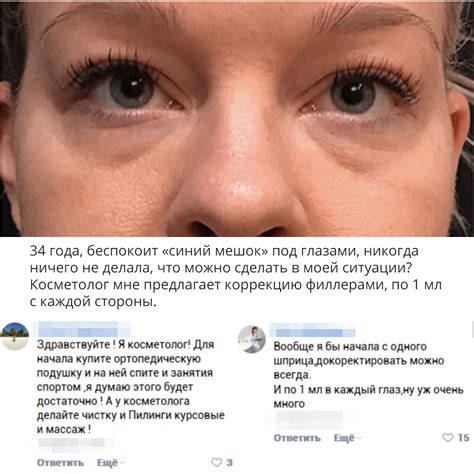 Эффективные способы избавиться от родинки под глазом