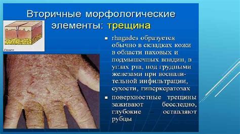  Физиологические особенности кожи мужчин 